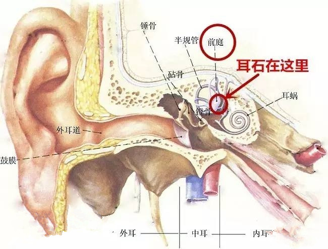 眩晕并伴有恶心 小心“耳石症”找上你