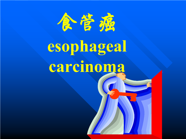 恒瑞发布卡瑞利珠单抗新研究结果 食管癌或将有免疫疗法