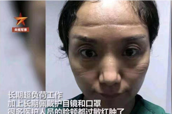 “当医生摘下口罩的瞬间”，战“疫”中的她们最美！