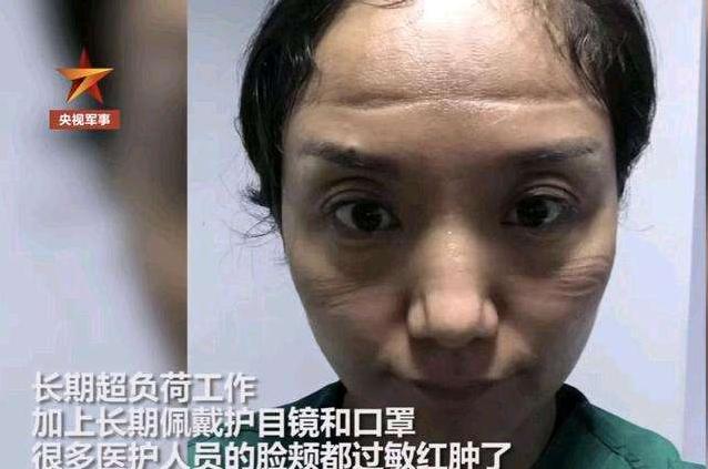 “当医生摘下口罩的瞬间”，战“疫”中的她们最美！