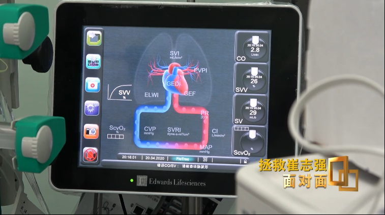 面对面丨看“史诗级救治”！全球首位新冠肺移植出院患者如何换肺重生？