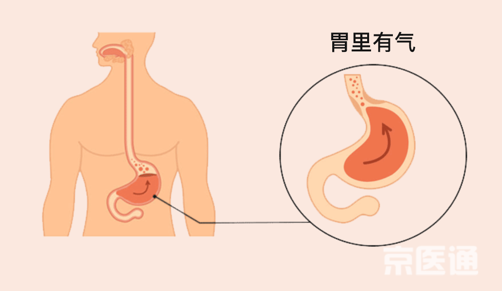 宣医科普|突然打嗝又止不住？医生给出了3种科学方法！