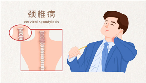 网传颈椎病“自救指南”靠谱吗？专家解读来了