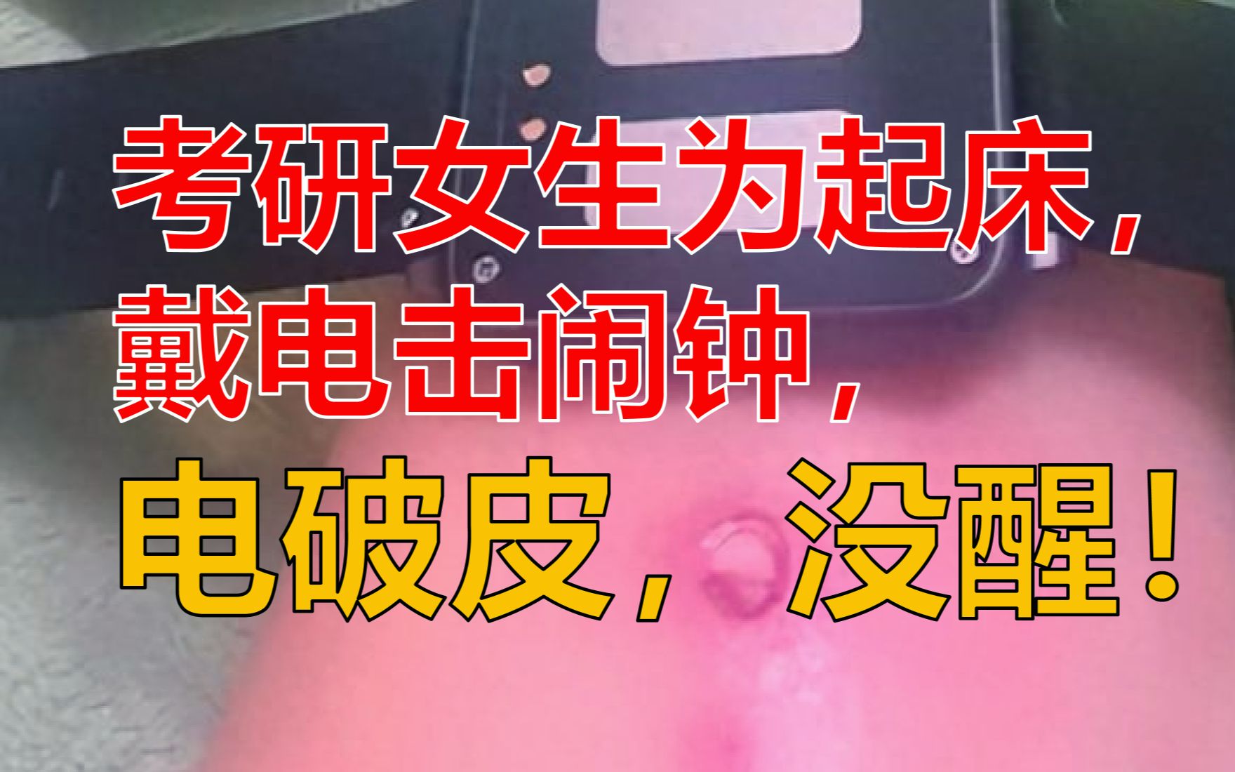 电击闹钟需谨慎使用 或造成局部电烧伤