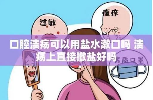 口腔溃疡 撒盐喝酒消毒有用吗？