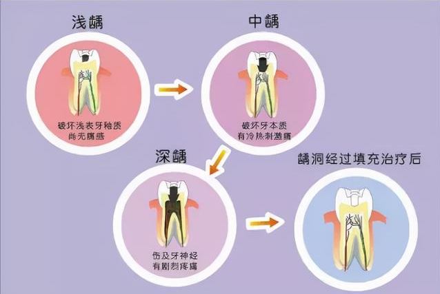 牙疼真相大揭秘 11个应对方案送给你