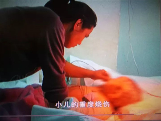 3岁半女孩掉进热水锅 奶奶发现拽住孩子两腿捞出