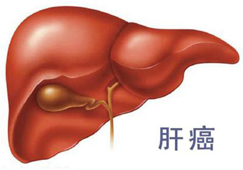 为什么肝癌早期难以发现？